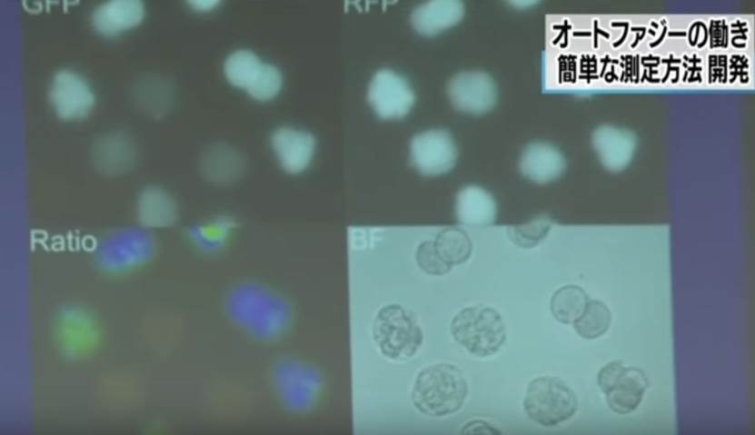 苗栗縣市三灣鄉汽車機車車禍強制險不賠賠償調解,苗栗縣市三灣鄉汽車機車車禍強制險賠不夠賠償調解,苗栗縣市三灣鄉汽車機車車禍強制險不賠退件賠償調解,苗栗縣市三灣鄉汽車機車車禍處理賠償調解,苗栗縣市三灣鄉汽車機車車禍案例賠償調解,苗栗縣市三灣鄉汽車機車車禍最高理賠賠償金額賠償調解,苗栗縣市三灣鄉汽車機車車禍法律顧問賠償調解,苗栗縣市三灣鄉汽車機車車禍醫院診斷書賠償調解,苗栗縣市三灣鄉汽車機車車禍理賠糾紛賠償調解,苗栗縣市三灣鄉汽車機車車禍理賠賠償調解糾紛賠償調解,苗栗縣市三灣鄉汽車機車車禍如何鑑定計算賠償調解,苗栗縣市三灣鄉汽車機車車禍精神損失如何計算賠償調解,苗栗縣市三灣鄉汽車機車車禍失能殘廢損失如何計算賠償賠償調解,苗栗縣市三灣鄉汽車機車車禍殘廢損失如何計算賠償賠償調解,苗栗縣市三灣鄉汽車機車車禍受傷無法工作損失如何計算賠償賠償調解,苗栗縣市三灣鄉汽車機車車禍理賠賠償調解糾紛賠償調解,苗栗縣市三灣鄉汽車機車車禍鑑定報告賠償調解,苗栗縣市三灣鄉汽車機車車禍鑑定委員會賠償調解,苗栗縣市三灣鄉汽車機車車禍受傷損失如何計算賠償調解 苗栗縣市三灣鄉汽車機車車禍強制險不賠賠償調解,苗栗縣市三灣鄉汽車機車車禍強制險賠不夠賠償調解,苗栗縣市三灣鄉汽車機車車禍強制險不賠退件賠償調解,苗栗縣市三灣鄉汽車機車車禍處理賠償調解,苗栗縣市三灣鄉汽車機車車禍案例賠償調解,苗栗縣市三灣鄉汽車機車車禍最高理賠賠償金額賠償調解,苗栗縣市三灣鄉汽車機車車禍法律顧問賠償調解,苗栗縣市三灣鄉汽車機車車禍醫院診斷書賠償調解,苗栗縣市三灣鄉汽車機車車禍理賠糾紛賠償調解,苗栗縣市三灣鄉汽車機車車禍理賠賠償調解糾紛賠償調解,苗栗縣市三灣鄉汽車機車車禍如何鑑定計算賠償調解,苗栗縣市三灣鄉汽車機車車禍精神損失如何計算賠償調解,苗栗縣市三灣鄉汽車機車車禍失能殘廢損失如何計算賠償賠償調解,苗栗縣市三灣鄉汽車機車車禍殘廢損失如何計算賠償賠償調解,苗栗縣市三灣鄉汽車機車車禍受傷無法工作損失如何計算賠償賠償調解,苗栗縣市三灣鄉汽車機車車禍理賠賠償調解糾紛賠償調解,苗栗縣市三灣鄉汽車機車車禍鑑定報告賠償調解,苗栗縣市三灣鄉汽車機車車禍鑑定委員會賠償調解,苗栗縣市三灣鄉汽車機車車禍受傷損失如何計算賠償調解